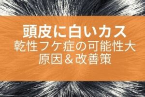 レビュー ロレアルの育毛剤 セリオキシルデンサーヘア 口コミは嘘じゃなかった 美容師のみちしるべ